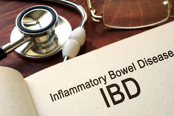 IBD Related Arthritis