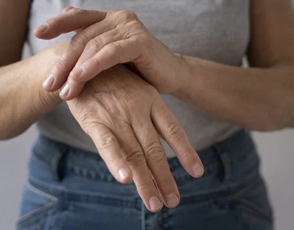 Rheumatoid Arthritis