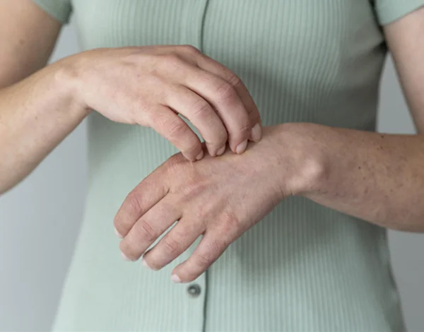 Connective Tissue Diseases